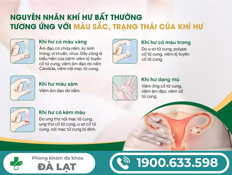 Hình ảnh minh họa